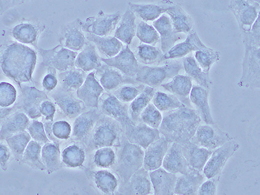 HeLa细胞.jpg